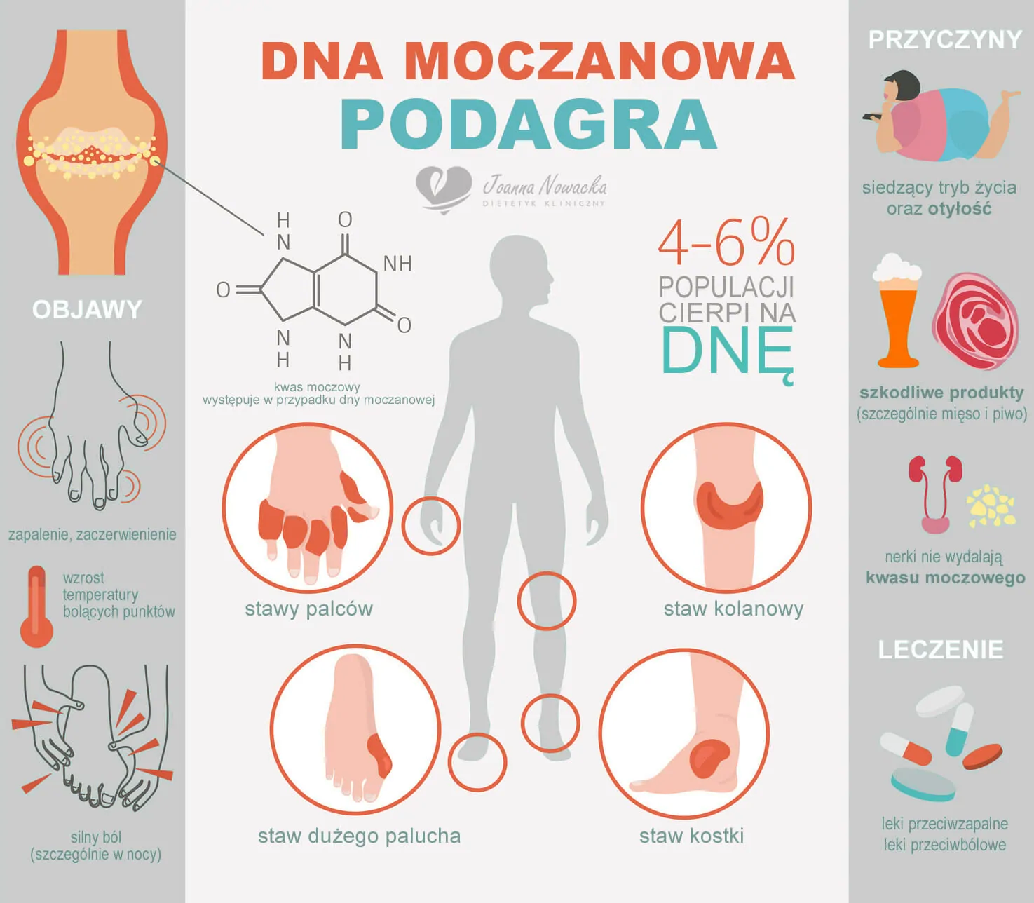 podagra artretyzm dna moczanowa.jpg objawy dny moczanowej
